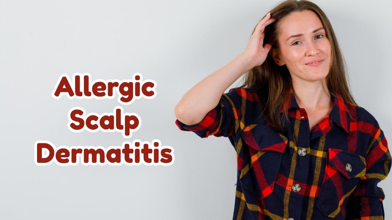 Allergic Scalp Dermatitis