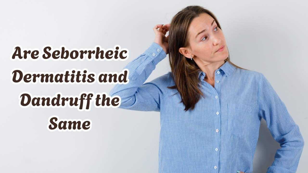 Are seborrheic dermatitis and dandruff the same