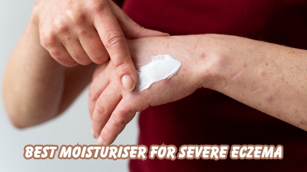 best moisturiser for severe eczema