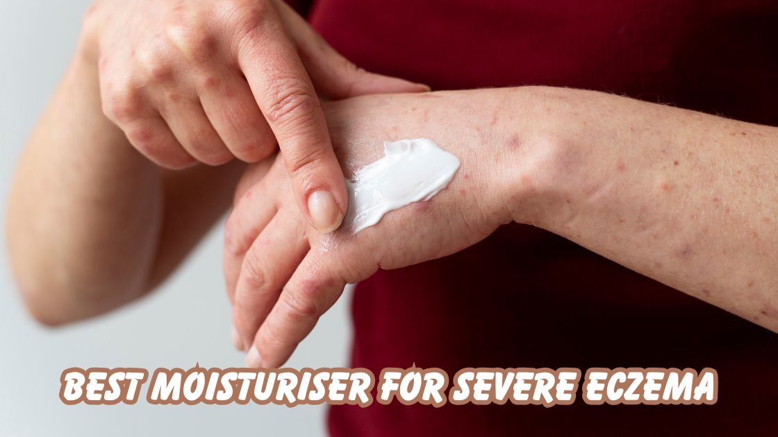 best moisturiser for severe eczema
