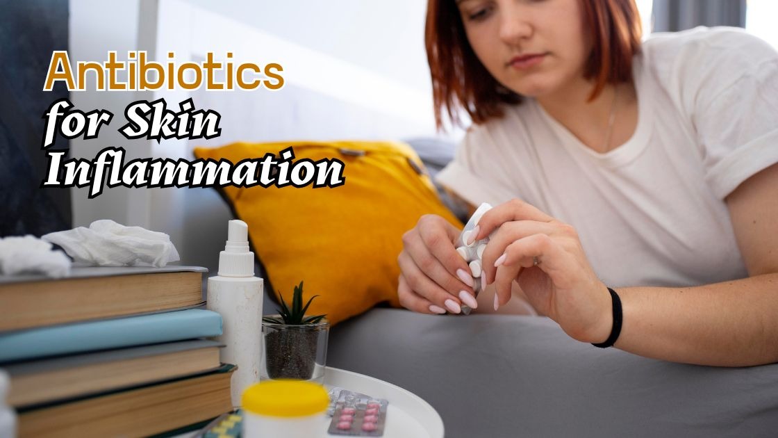 antibiotics for skin inflammation