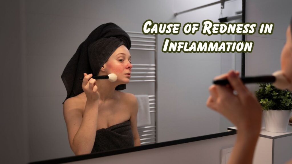 cause of redness in inflammation