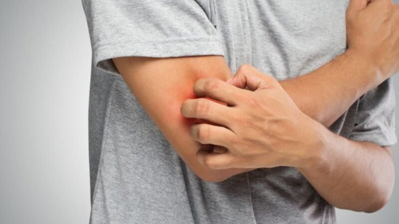 What Is the Cause of Redness in Inflammation? Complete Guide ...