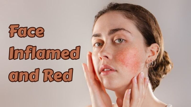 face inflamed and red
