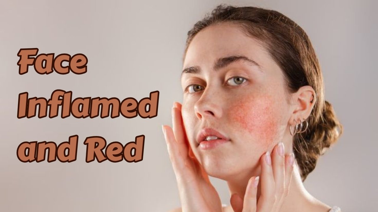 face inflamed and red