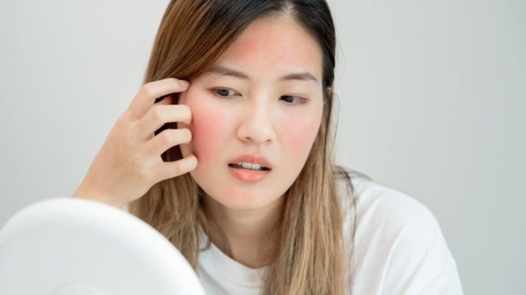 sensitive red face