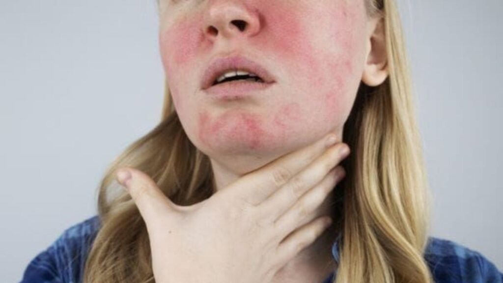 allergic reactions