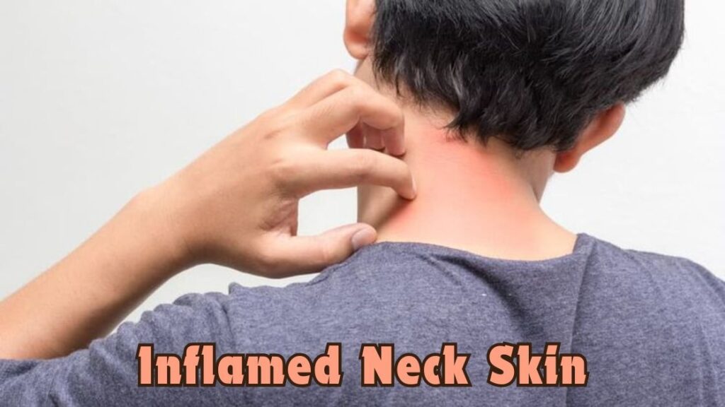 Inflamed neck skin