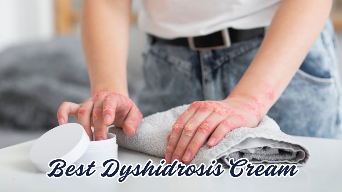 best dyshidrosis cream