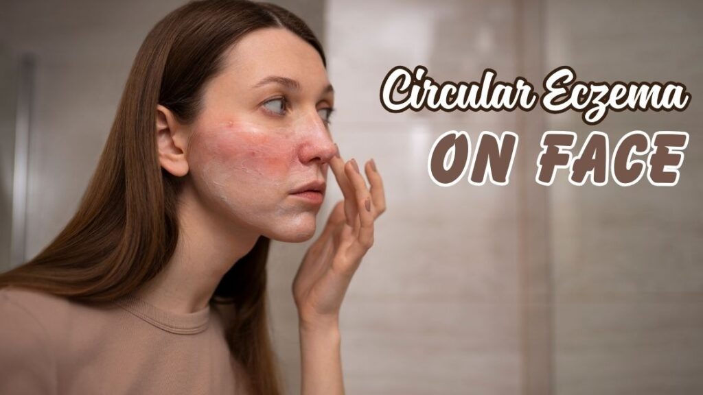 Circular eczema on face