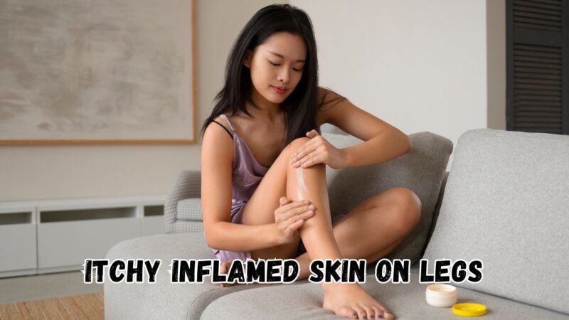 Itchy inflamed skin on legs