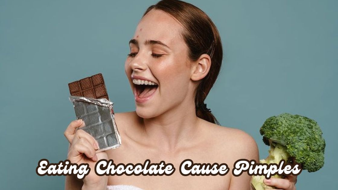 eating chocolate cause pimples