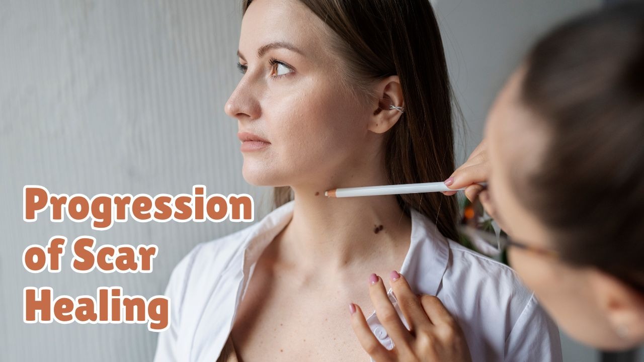 progression of scar healing