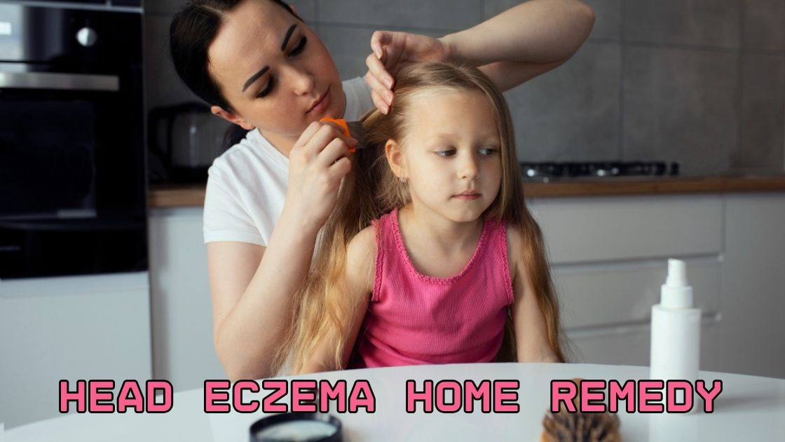 head eczema home remedy