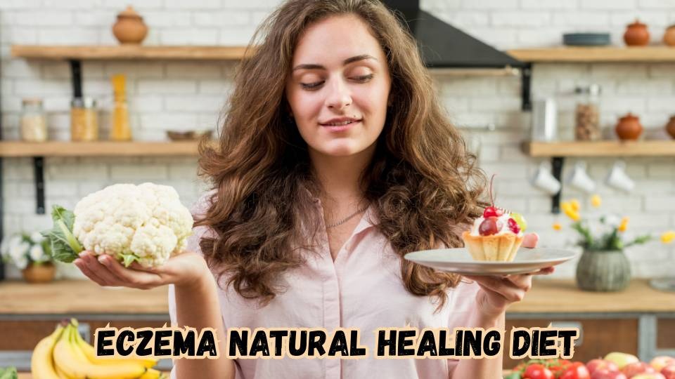 eczema natural healing diet