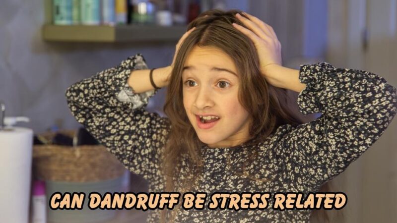 can dandruff be stress related
