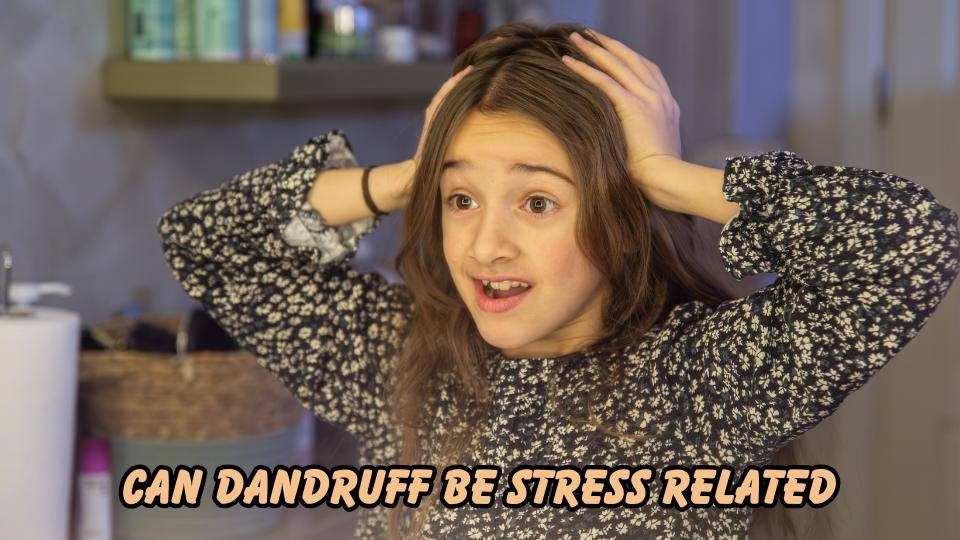 can dandruff be stress related
