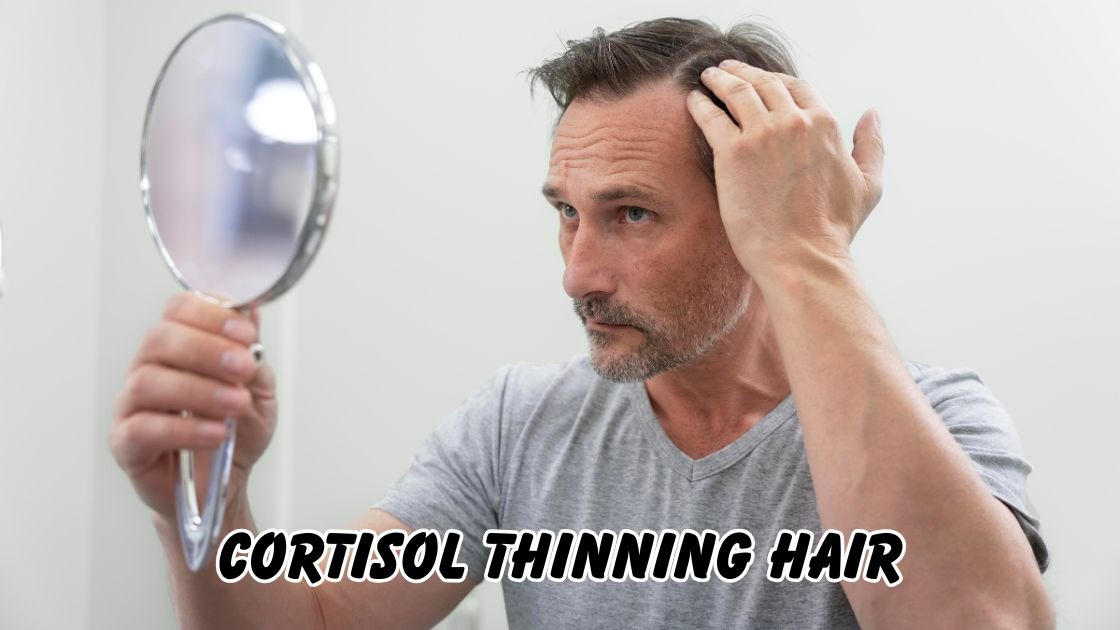 Cortisol thinning hair