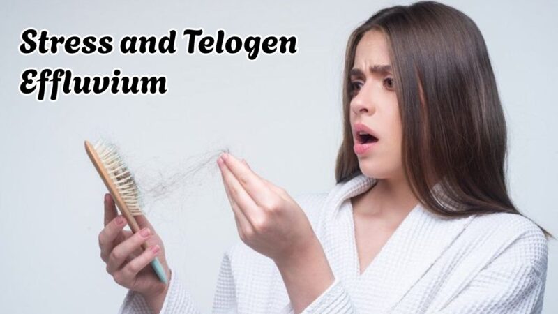 Stress and telogen effluvium