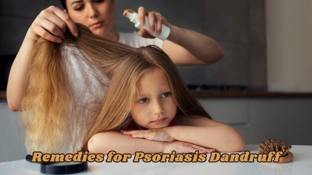 remedies for psoriasis dandruff