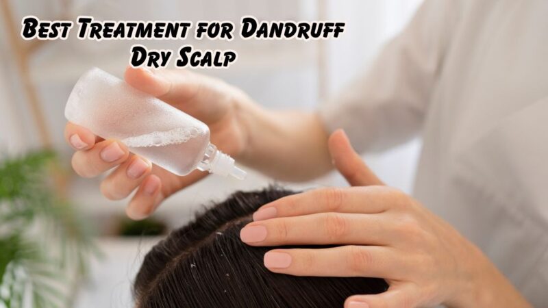 best treatment for dandruff dry scalp