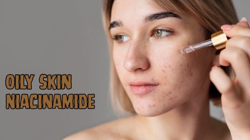 Oily skin niacinamide