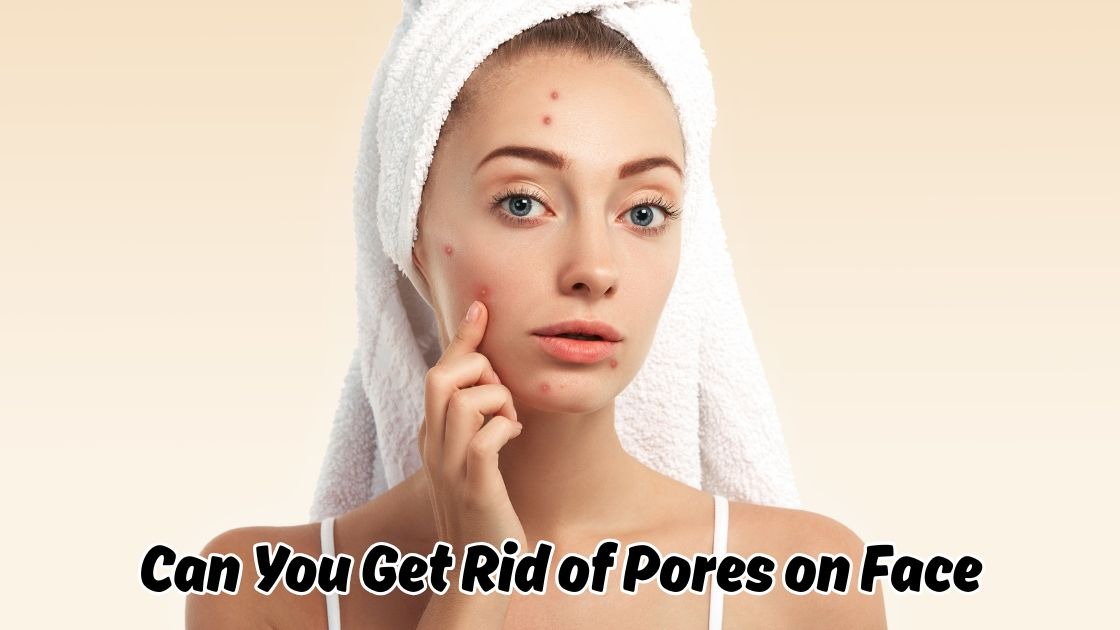 can you get rid of pores on face