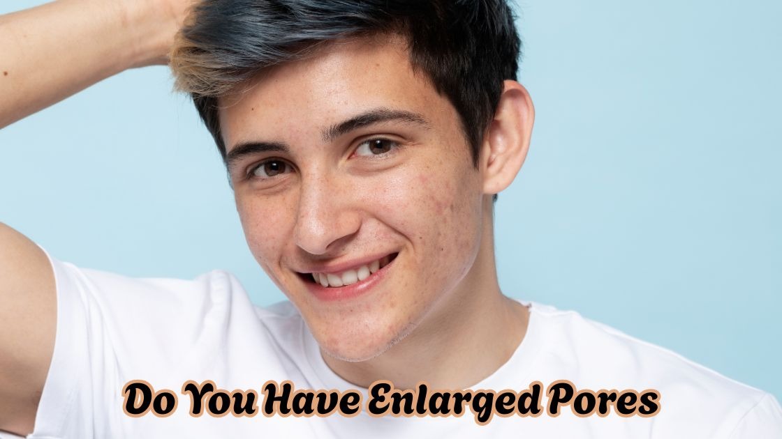 do you have enlarged pores