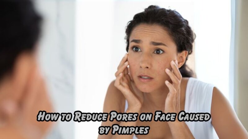 how to reduce pores on face caused by pimples