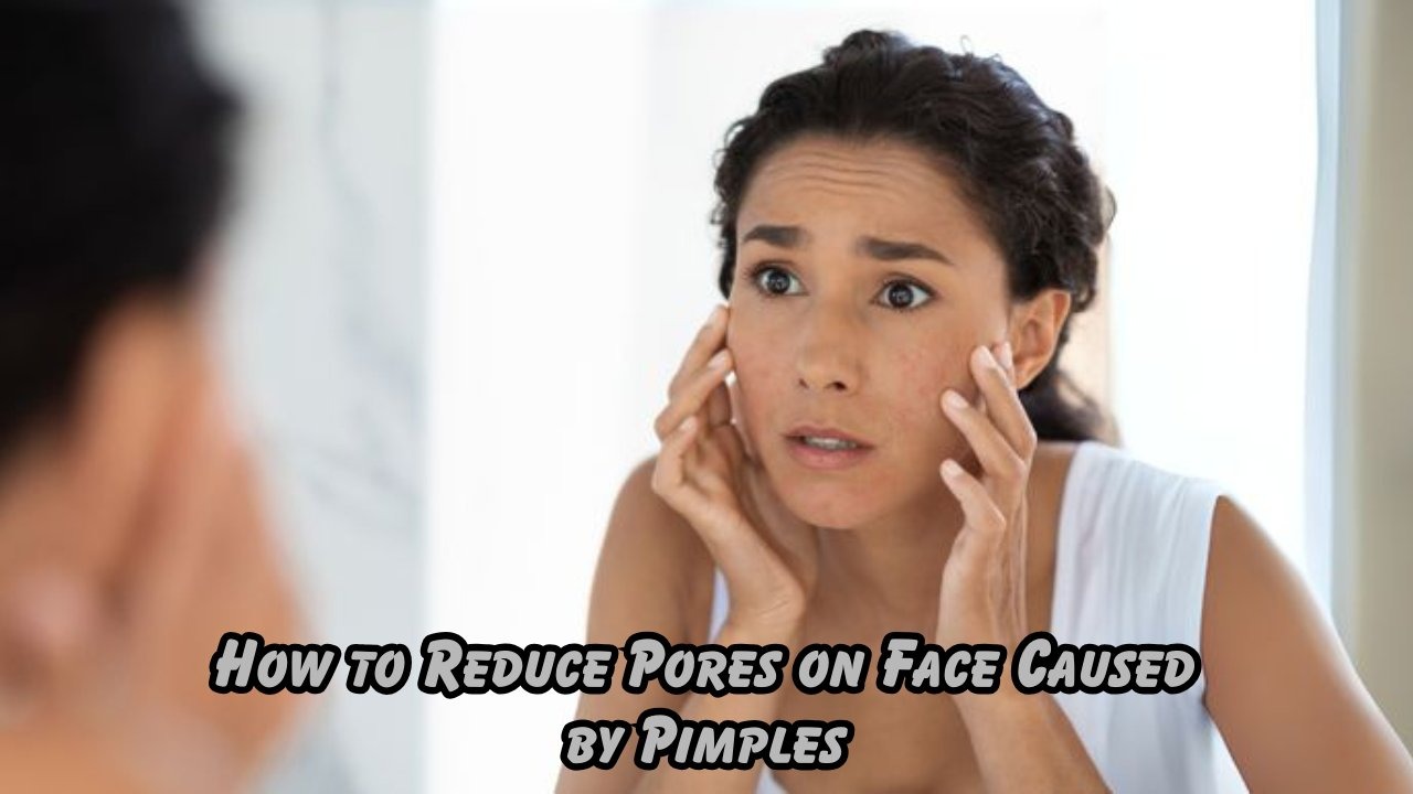 how to reduce pores on face caused by pimples