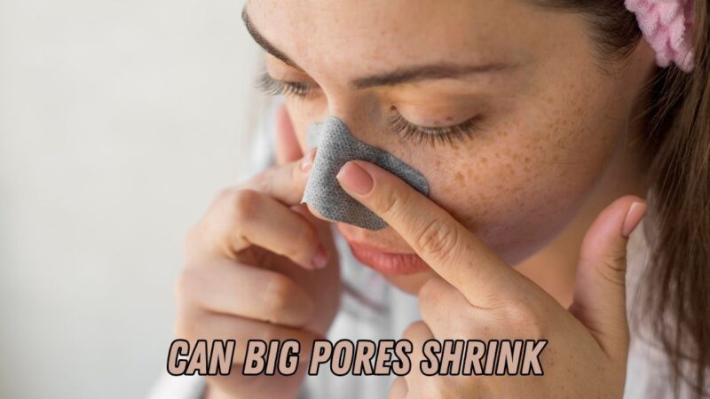 can big pores shrink