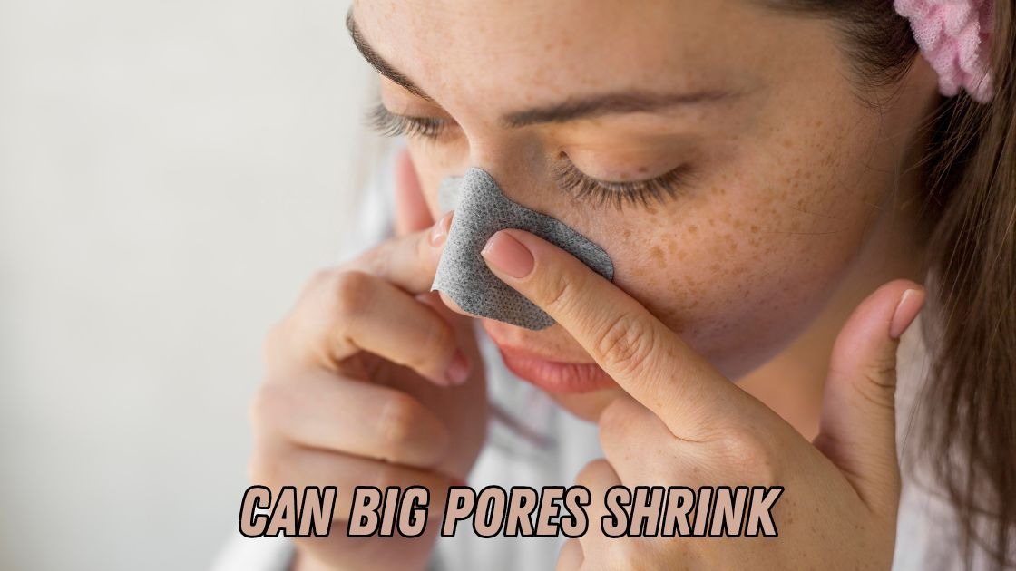 can big pores shrink