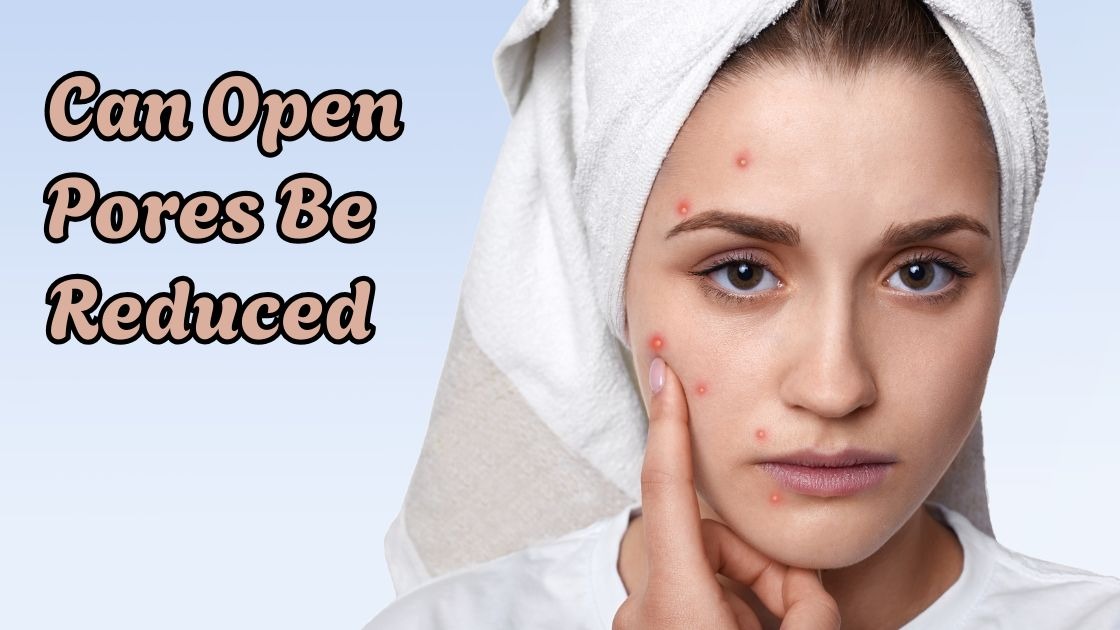 can open pores be reduced