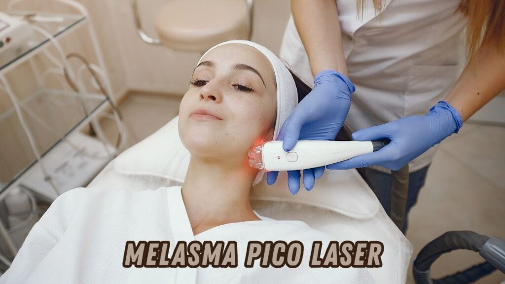 Melasma pico laser