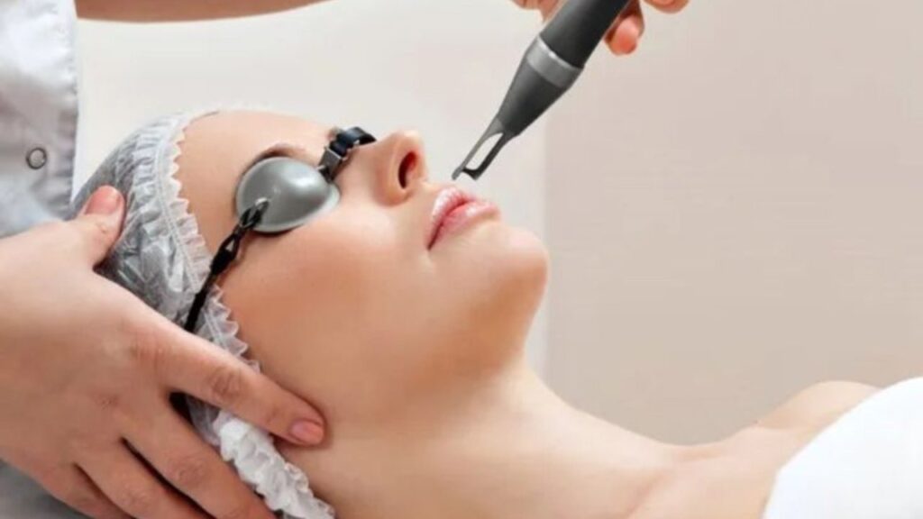 laser treatment