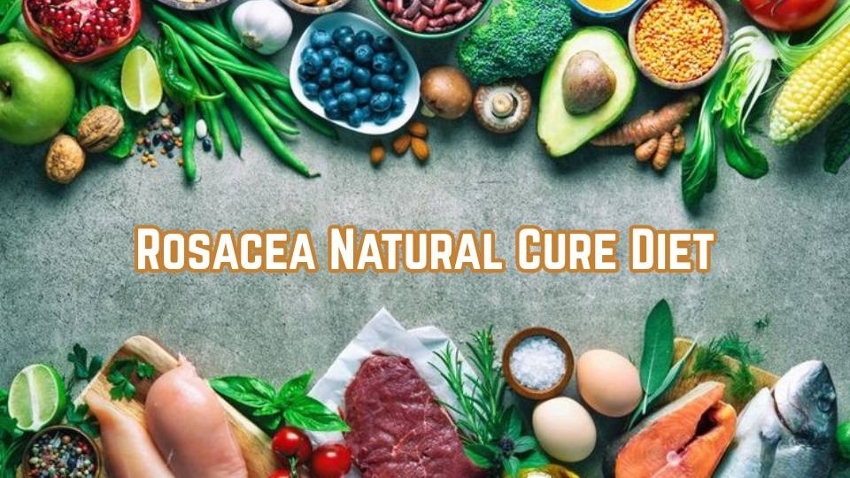 rosacea natural cure diet