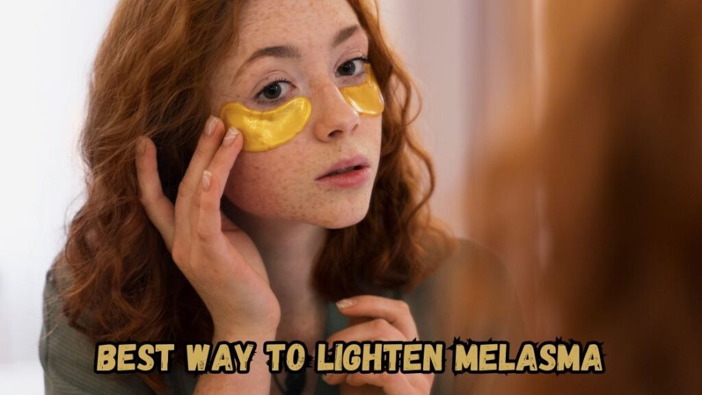 best way to lighten melasma