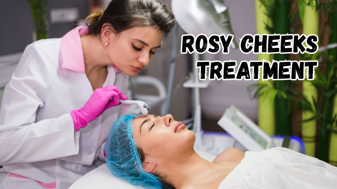 rosy cheeks treatment