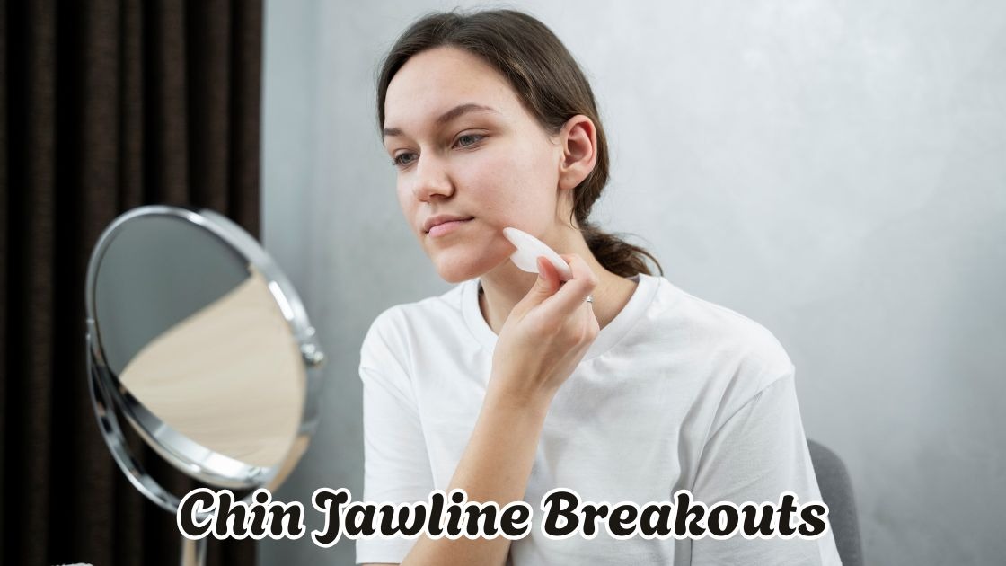 chin jawline breakouts