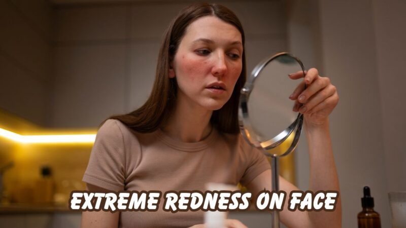 Extreme redness on face
