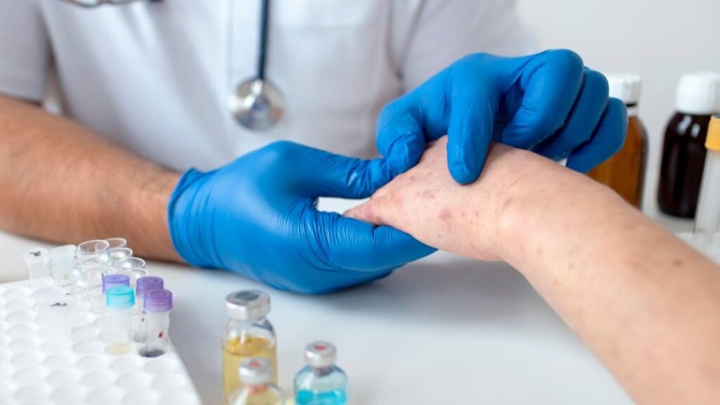 antifungal treatment