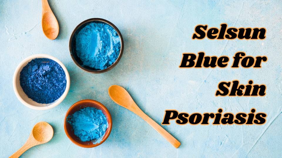 Selsun Blue for skin psoriasis