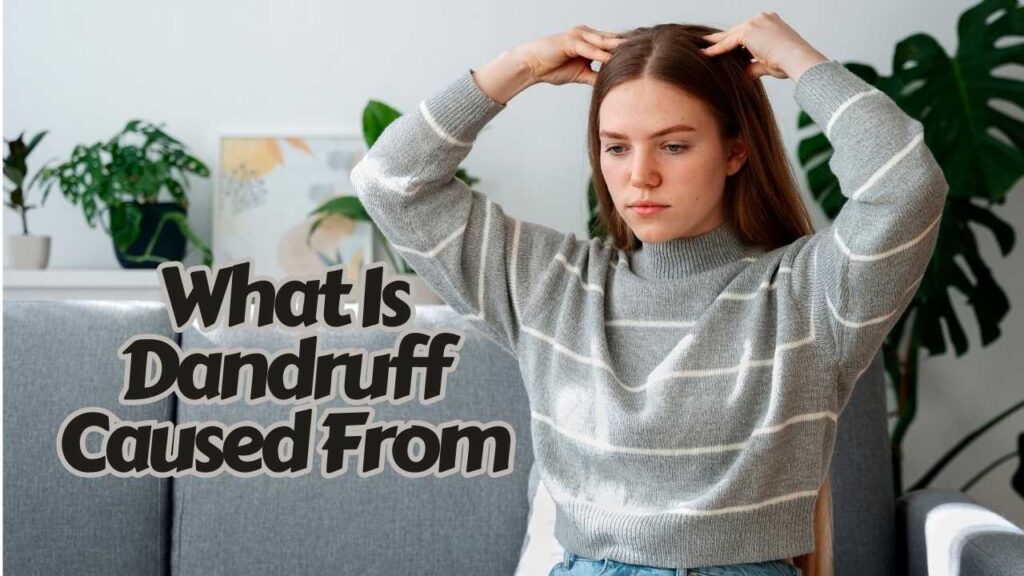 what is dandruff caused from