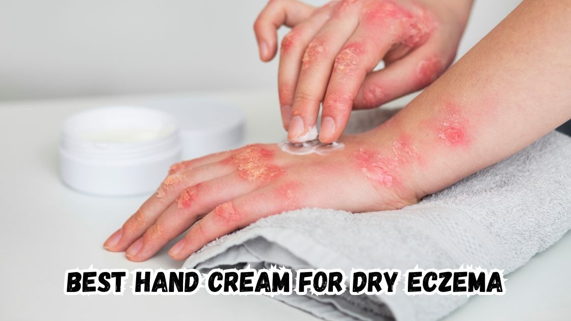 best hand cream for dry eczema
