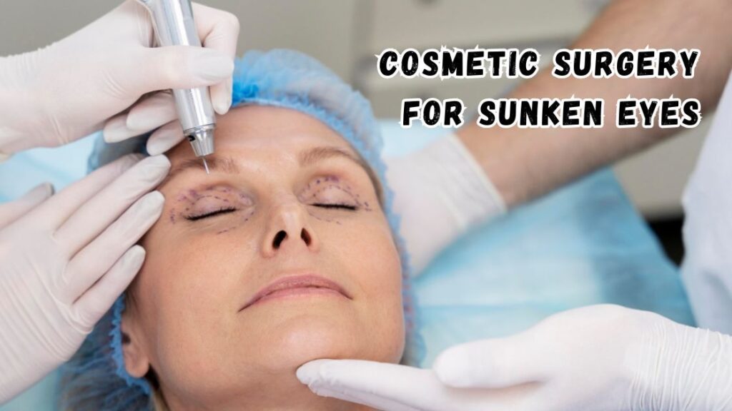 Cosmetic surgery for sunken eyes