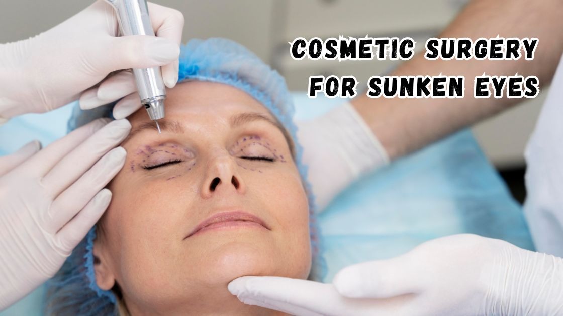 Cosmetic surgery for sunken eyes