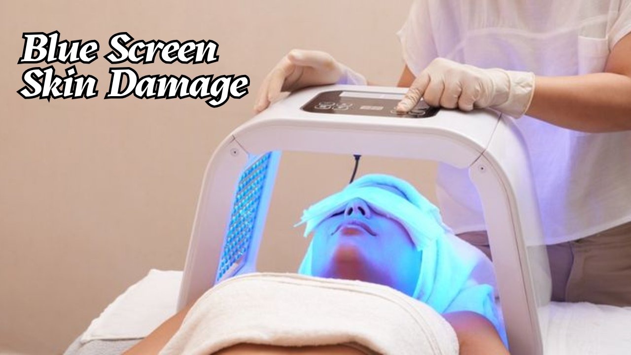 Blue Screen Skin Damage