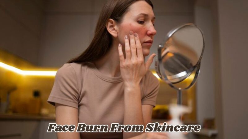 Face Burn From Skincare