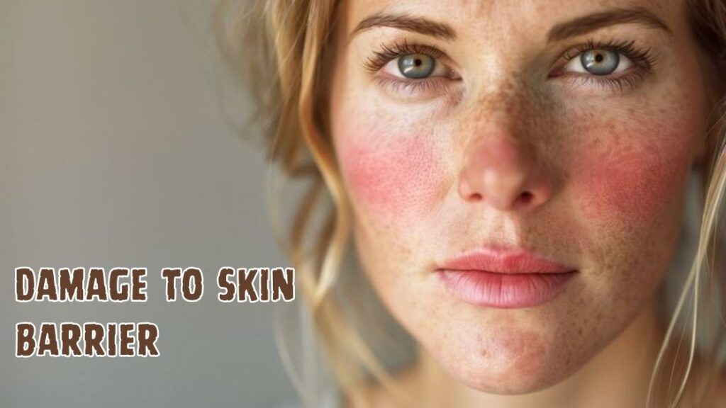 Damage to skin barrier