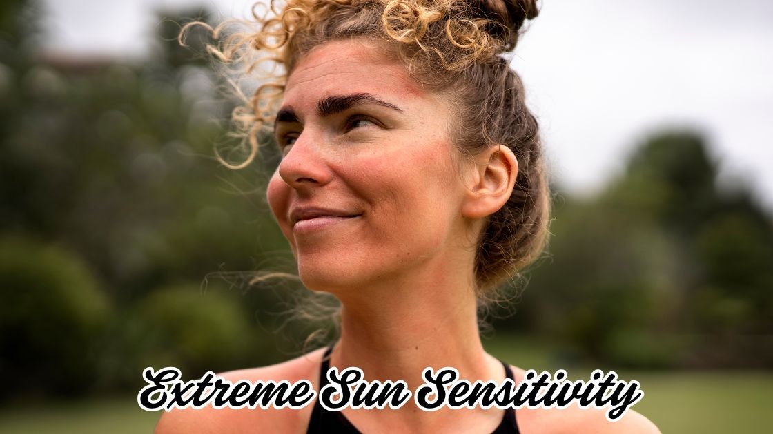Extreme Sun Sensitivity